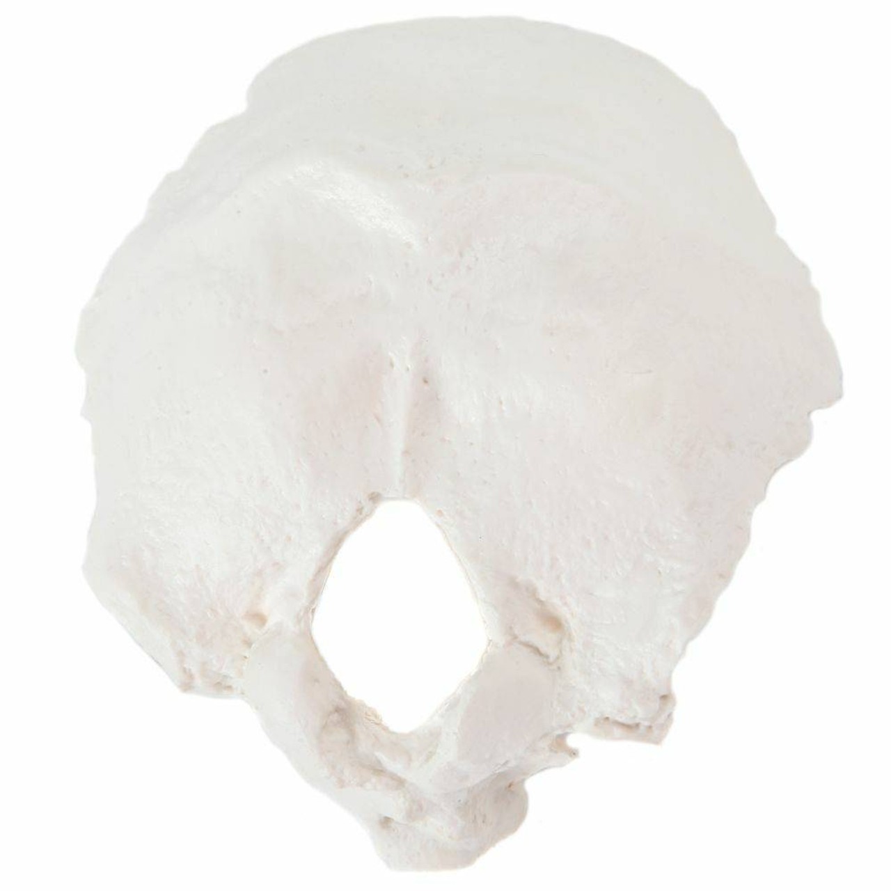 Axis Scientific Occipital Bone