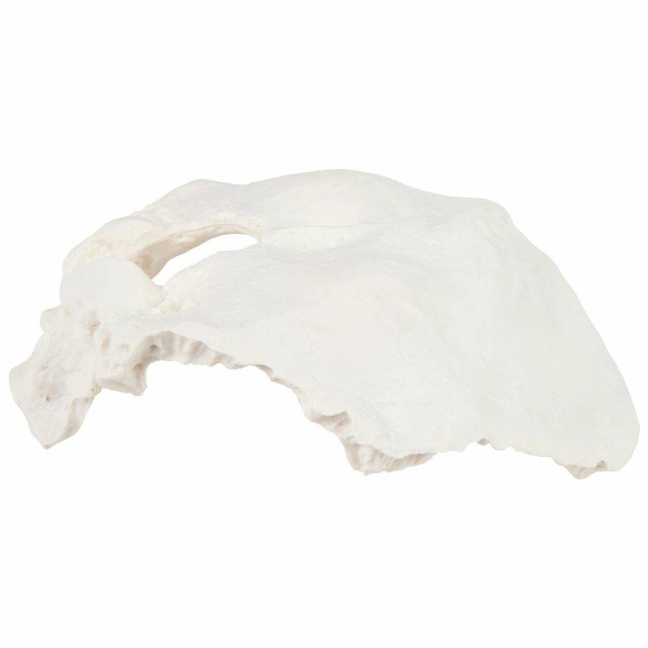 Axis Scientific Occipital Bone