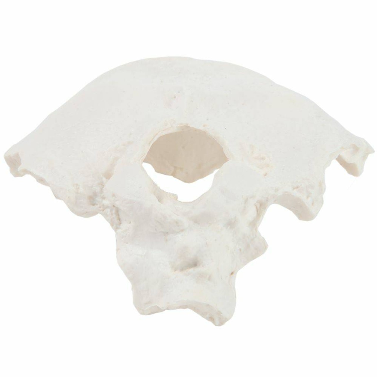 Axis Scientific Occipital Bone
