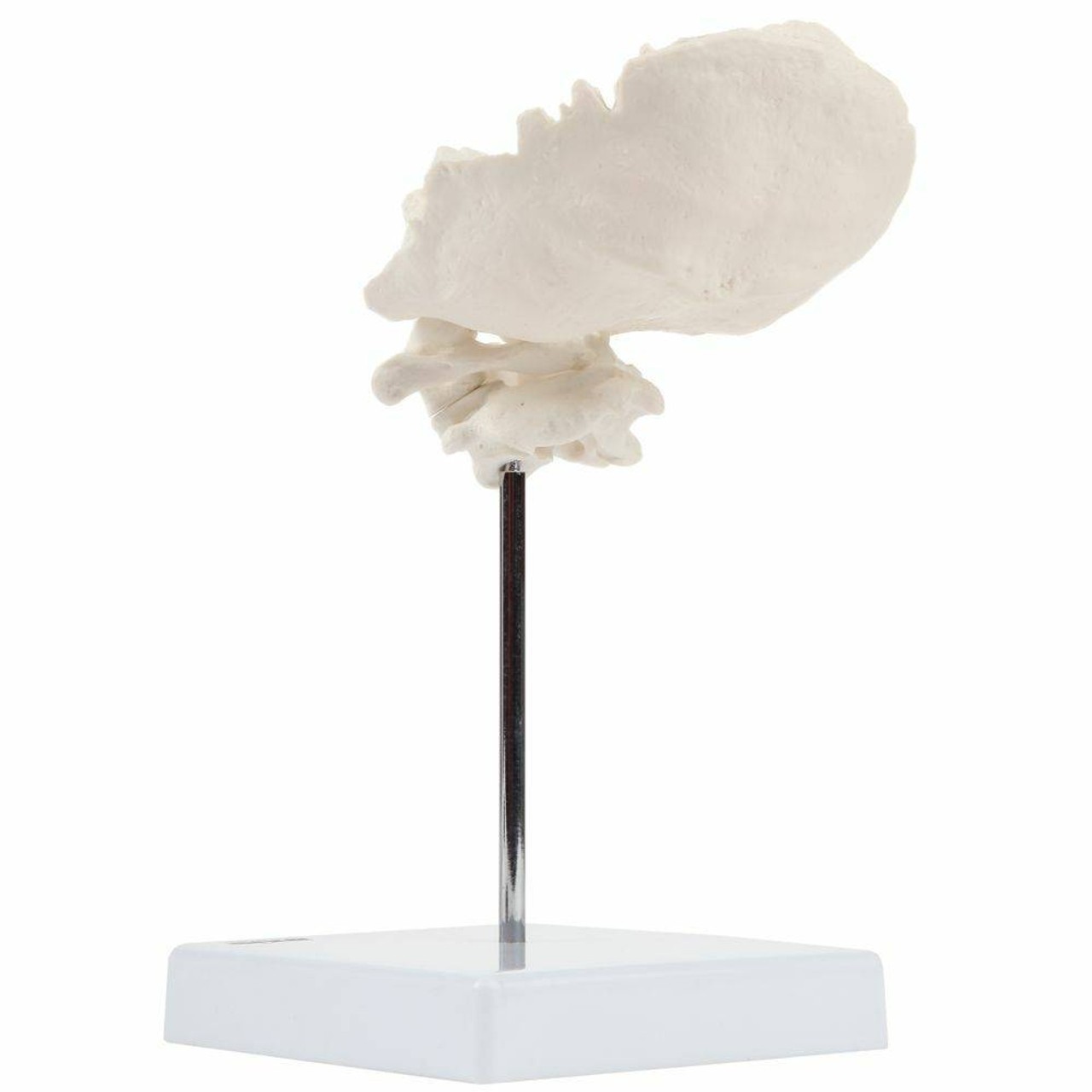 Axis Scientific Occipital Bone - C1 and C2