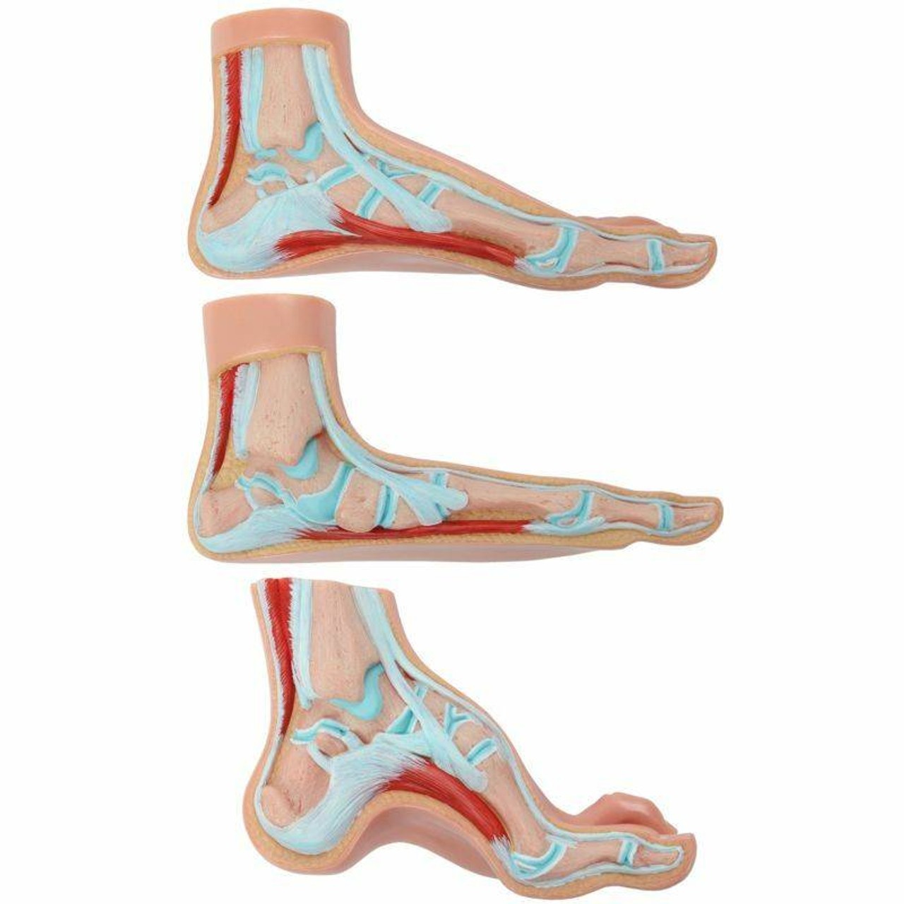 Axis Scientific Set of 3 Feet - Flat Foot, Arched Foot and