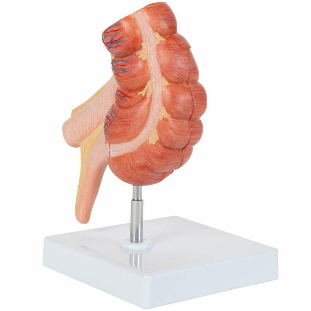 Axis Scientific Caecum and Appendix, Enlarged 1.5 Times Life Size