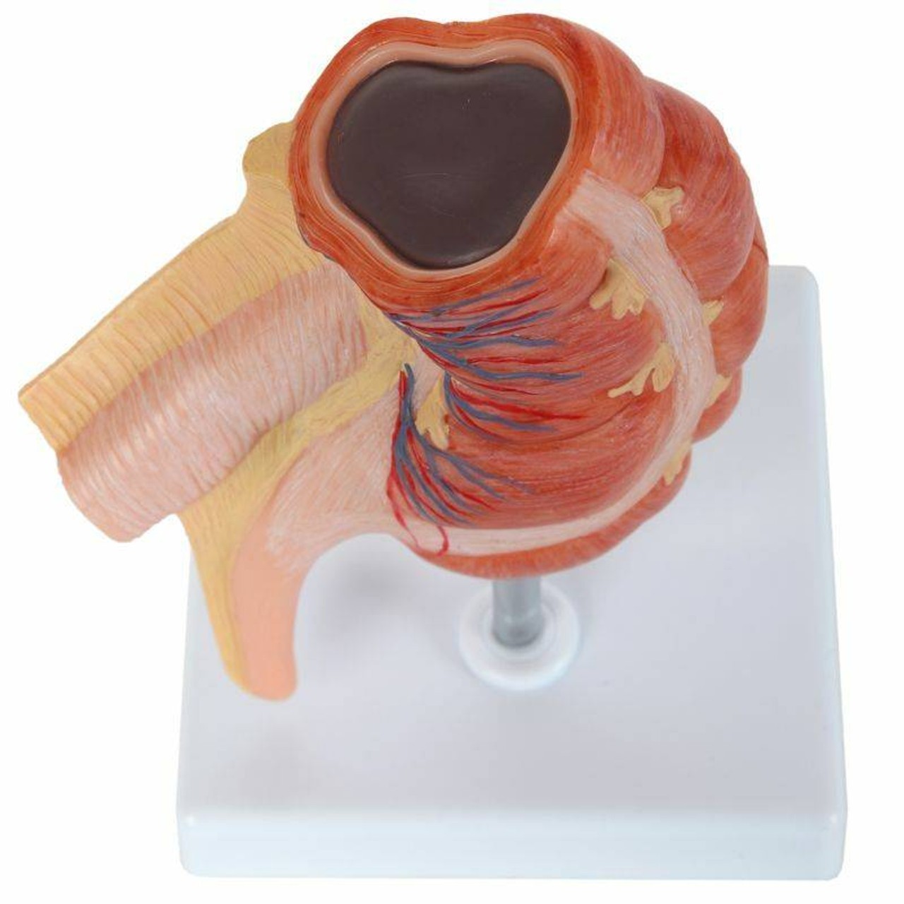 Axis Scientific Caecum and Appendix, Enlarged 1.5 Times Life Size