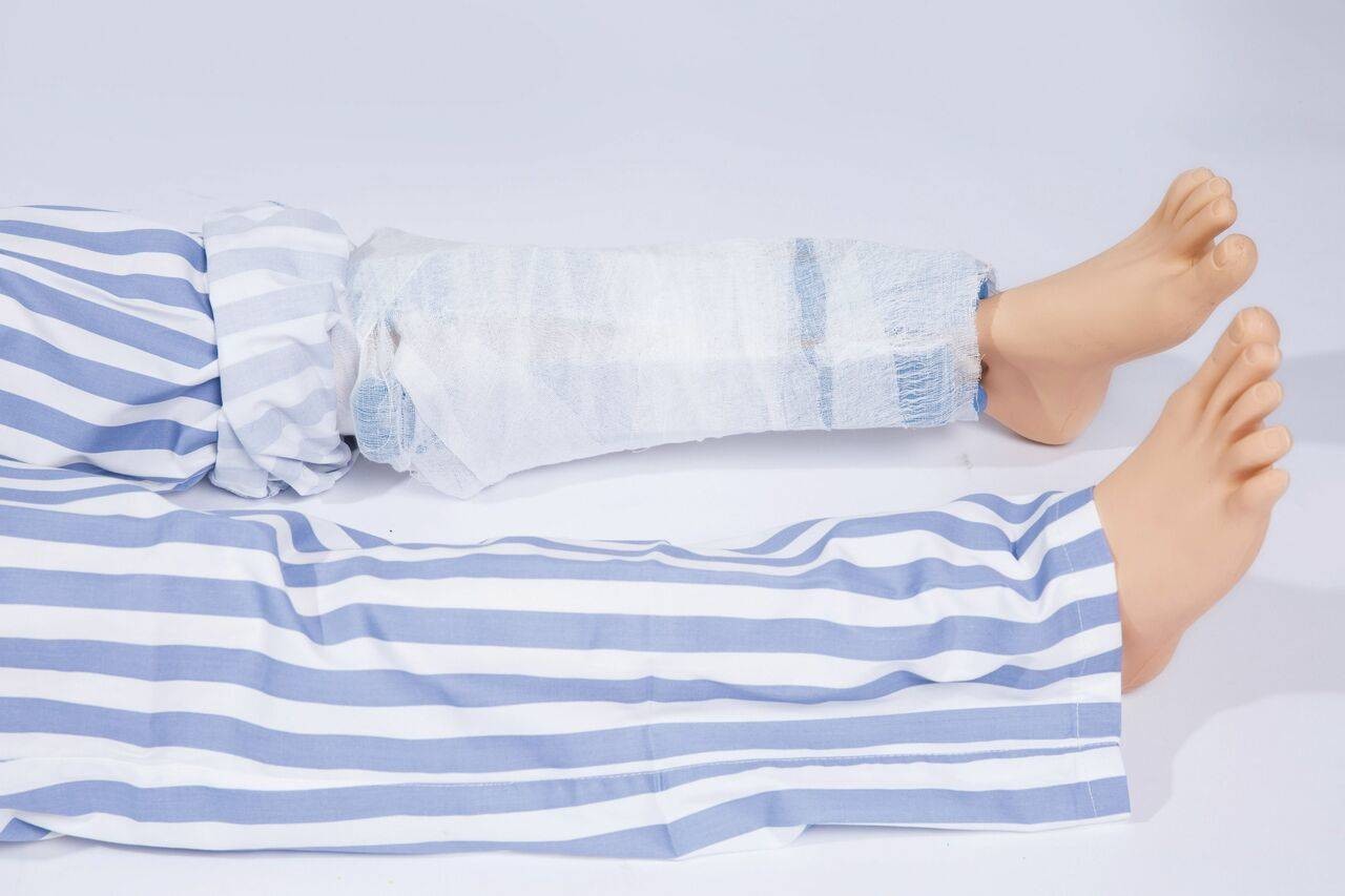 DISCONTINUED Anatomy Lab Closed Fracture of Limbs Trainer