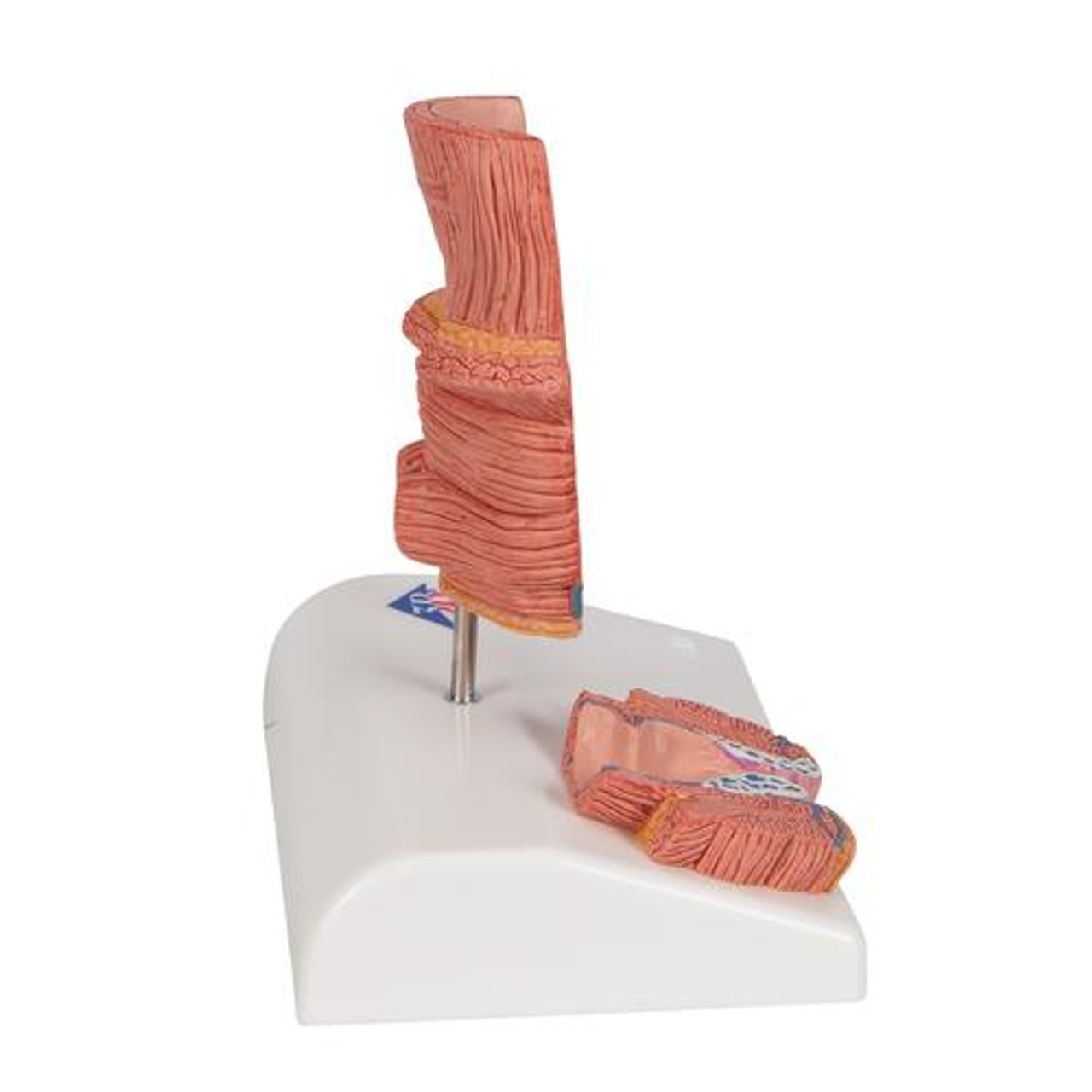Hemorrhoid Anatomy Model - Right Side View