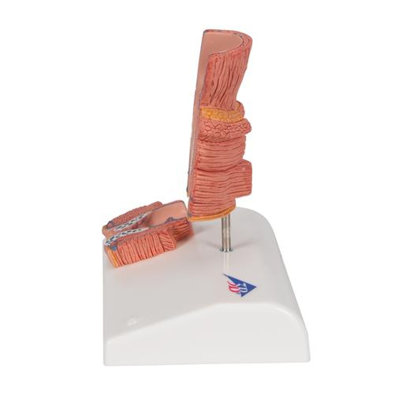 Hemorrhoid Anatomy Model - Left Side View