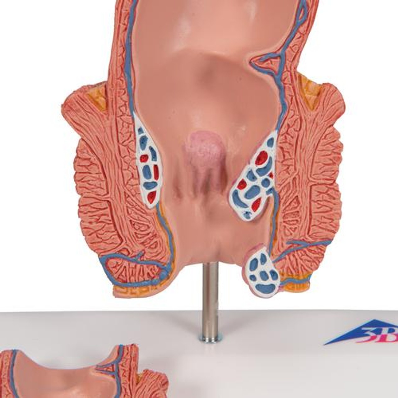 Hemorrhoid Anatomy Model - Zoom View