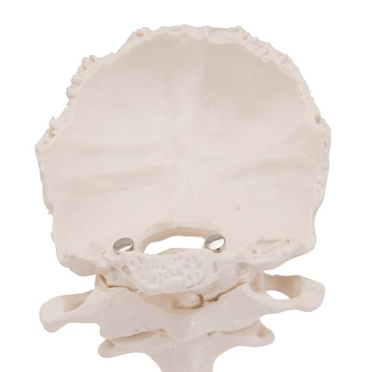 Atlas and Axis Bones Anatomy Model With Occipital Plate - Zoom View