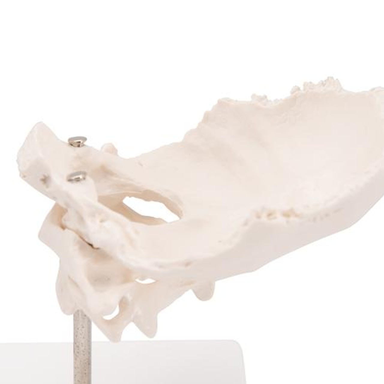 Atlas and Axis Bones Anatomy Model With Occipital Plate - Zoom View
