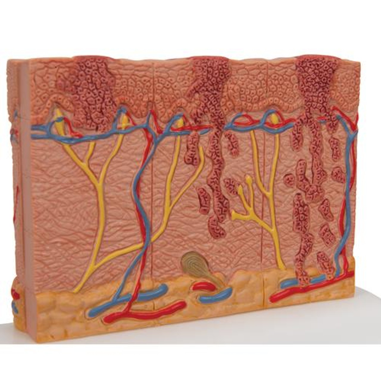 Skin Cancer Stages Model - Zoom View