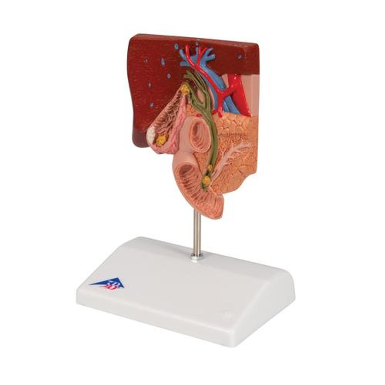 Gallstone Anatomy Model