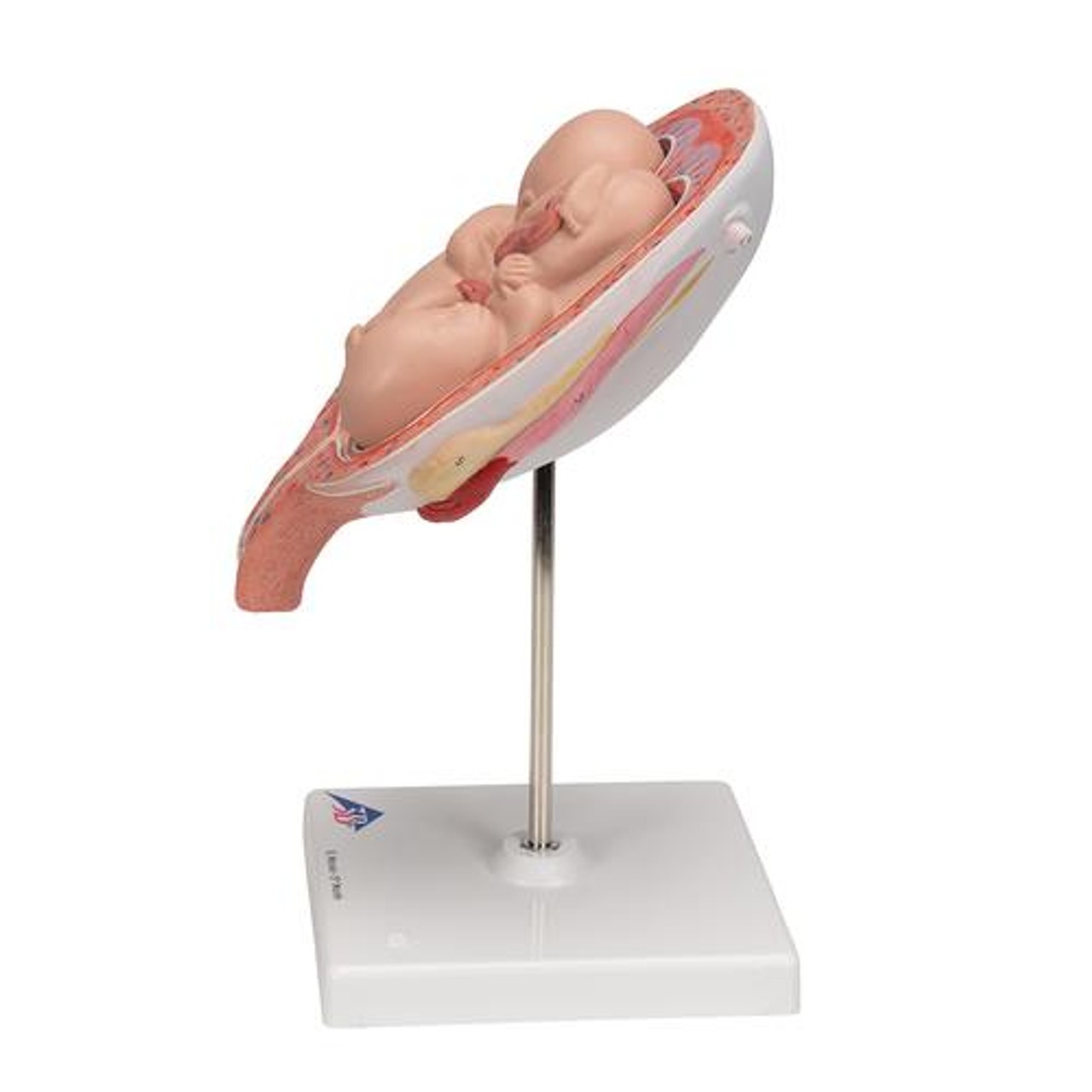 5th Month Human Twin Fetus Model - Left Side View