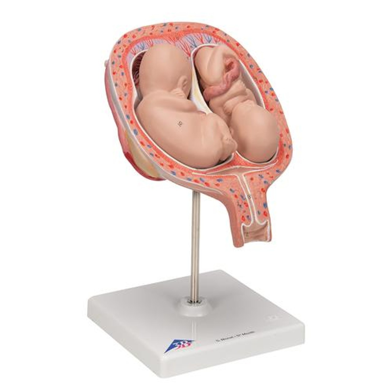 5th Month Human Twin Fetus Model - Right Side View