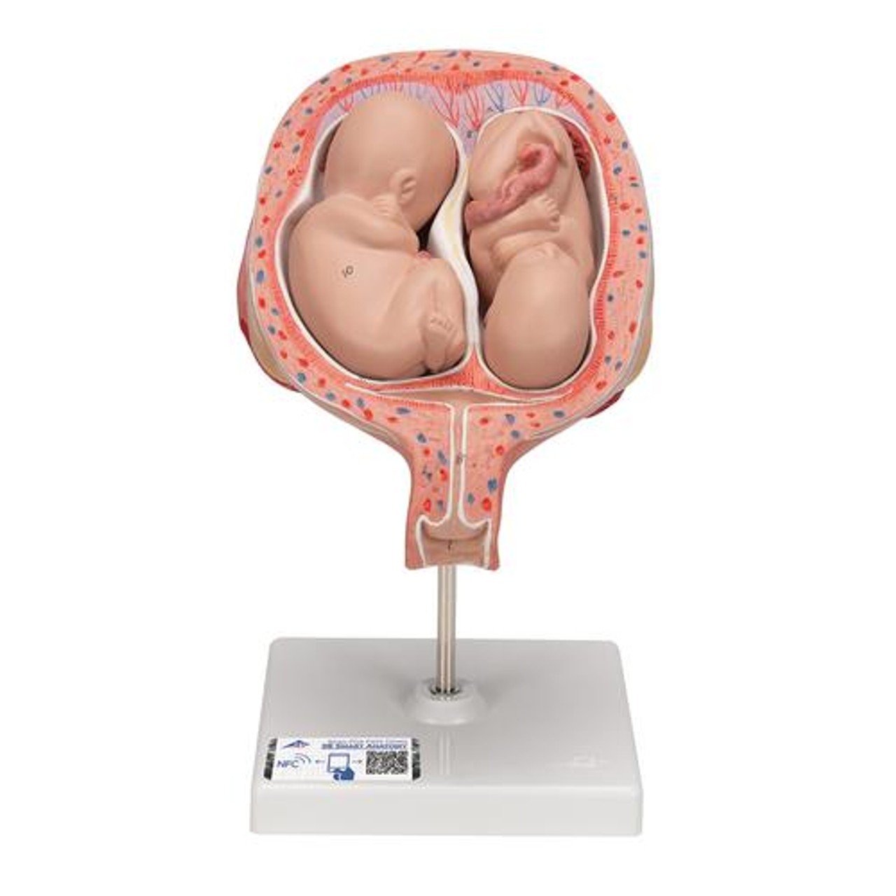 5th Month Human Twin Fetus Model