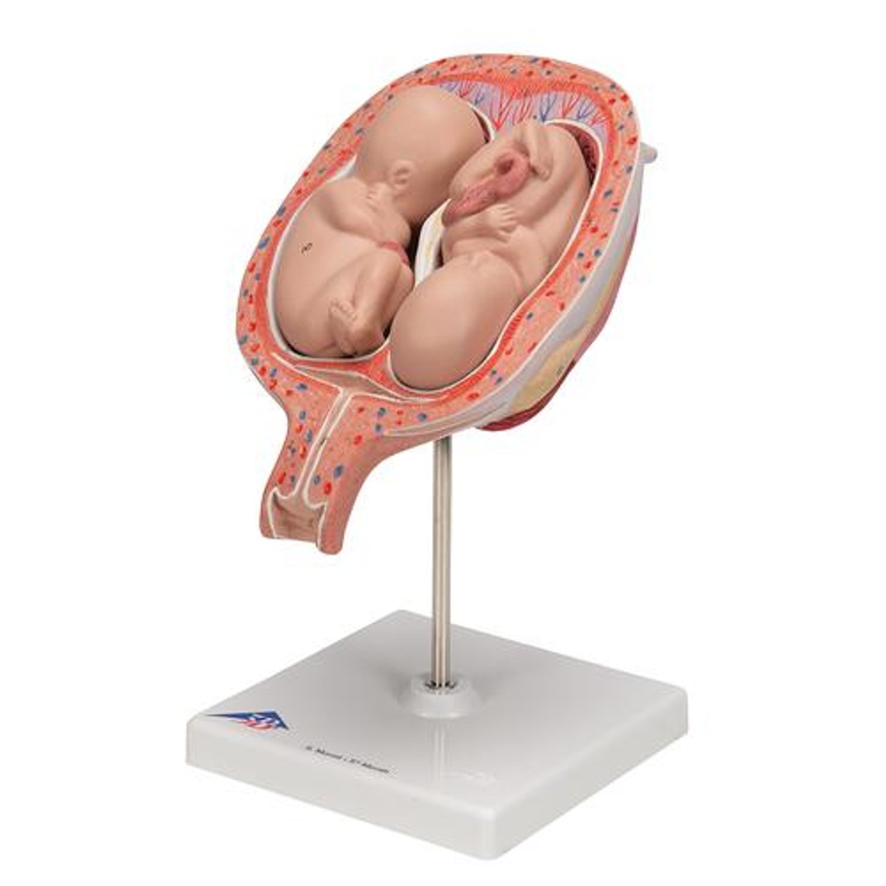 5th Month Human Twin Fetus Model - Left Side View
