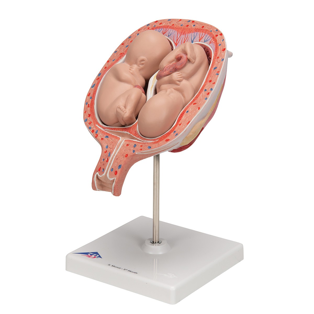 5th Month Human Twin Fetus Model