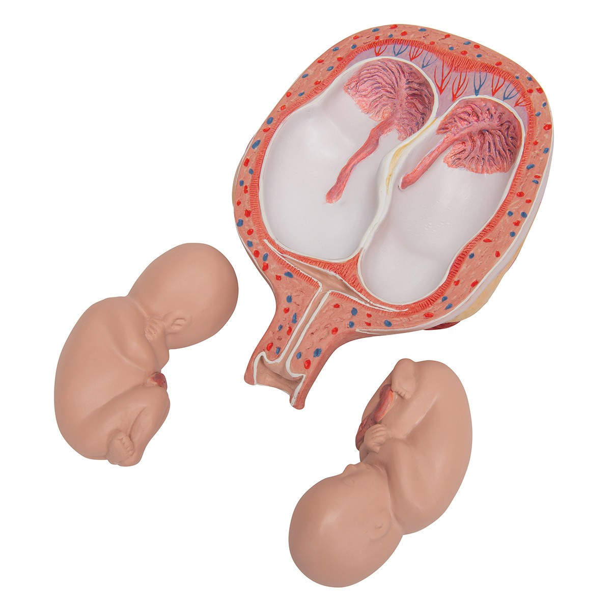 5th Month Human Twin Fetus Model