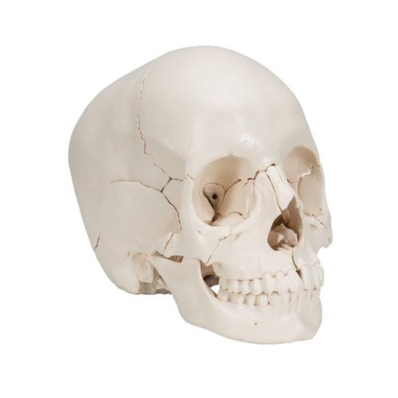 Beauchene Skull in 22 Parts - Right Side View
