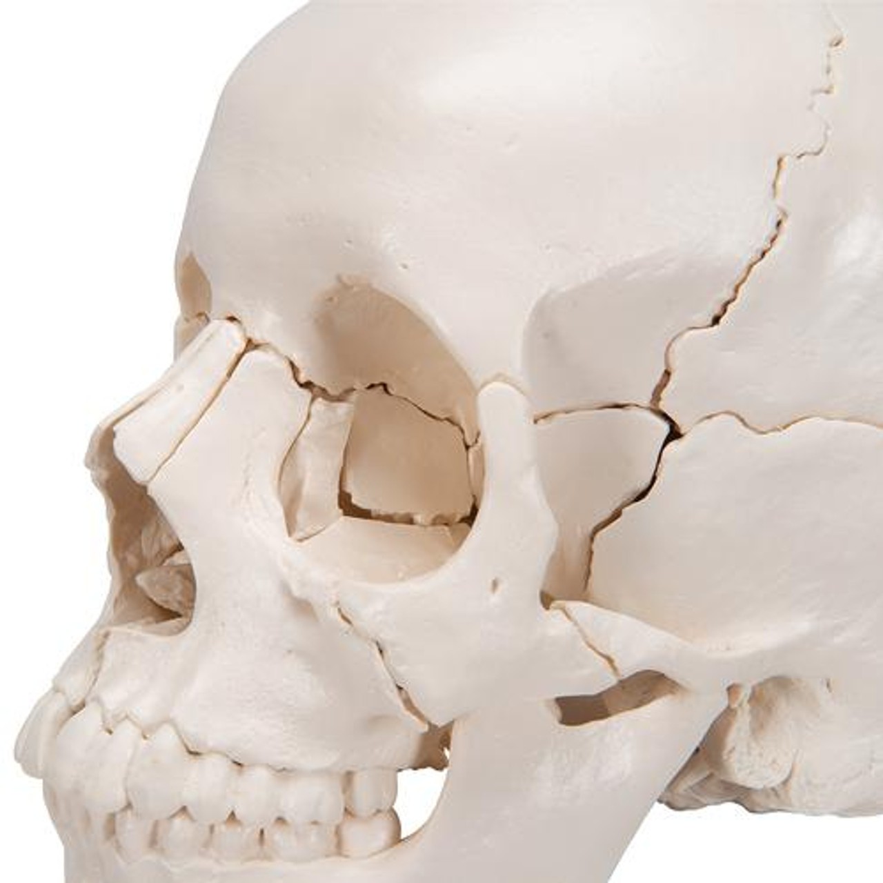 Beauchene Skull in 22 Parts - Left View Zoom