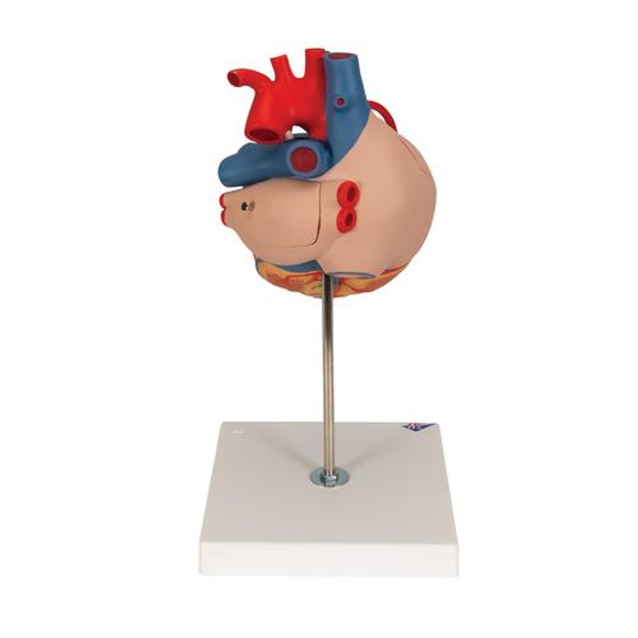 Human Heart Anatomy Model With Bypass - Back View