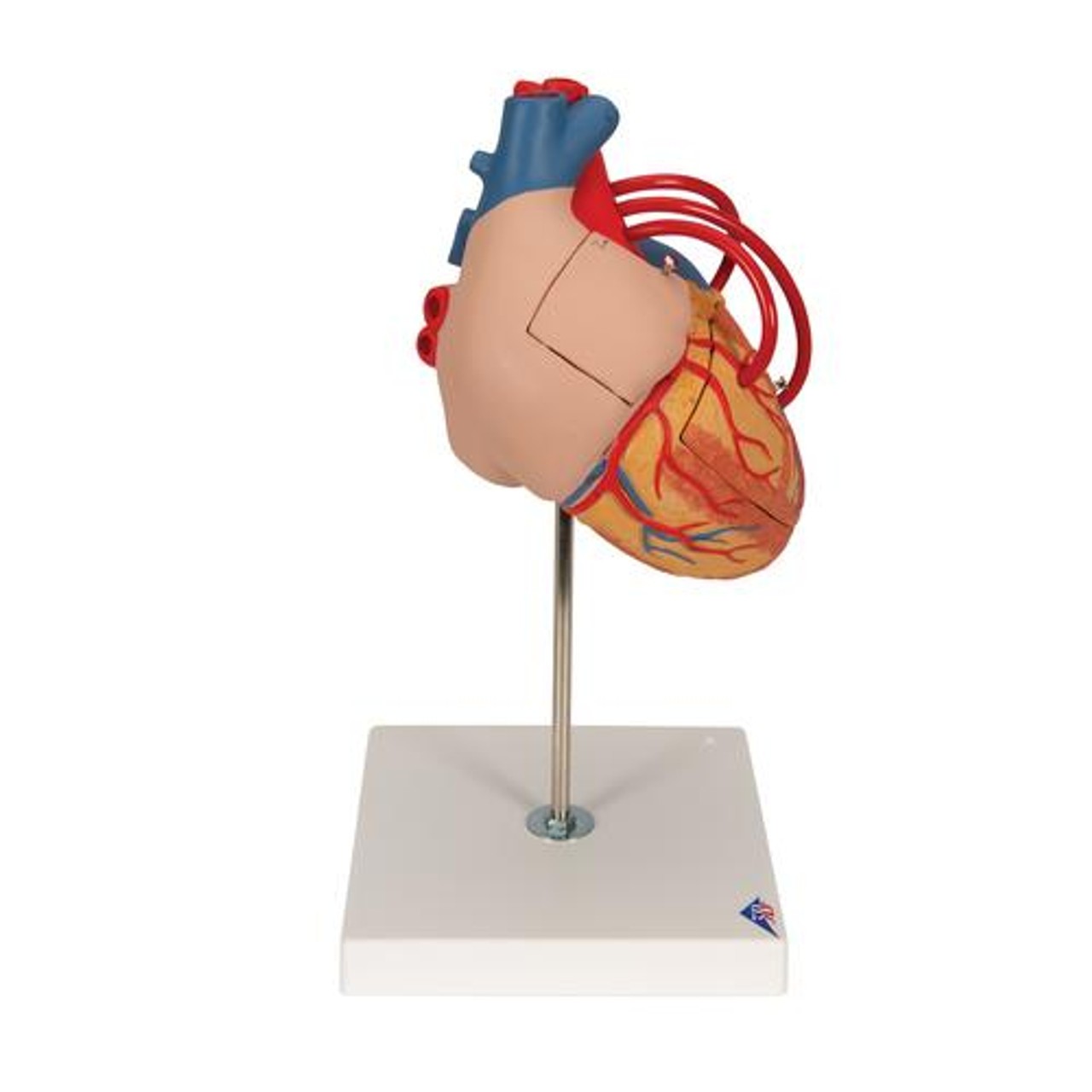 Human Heart Anatomy Model With Bypass - Right Side View