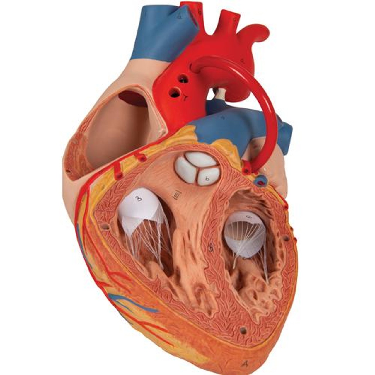 Human Heart Anatomy Model With Bypass - Zoom View