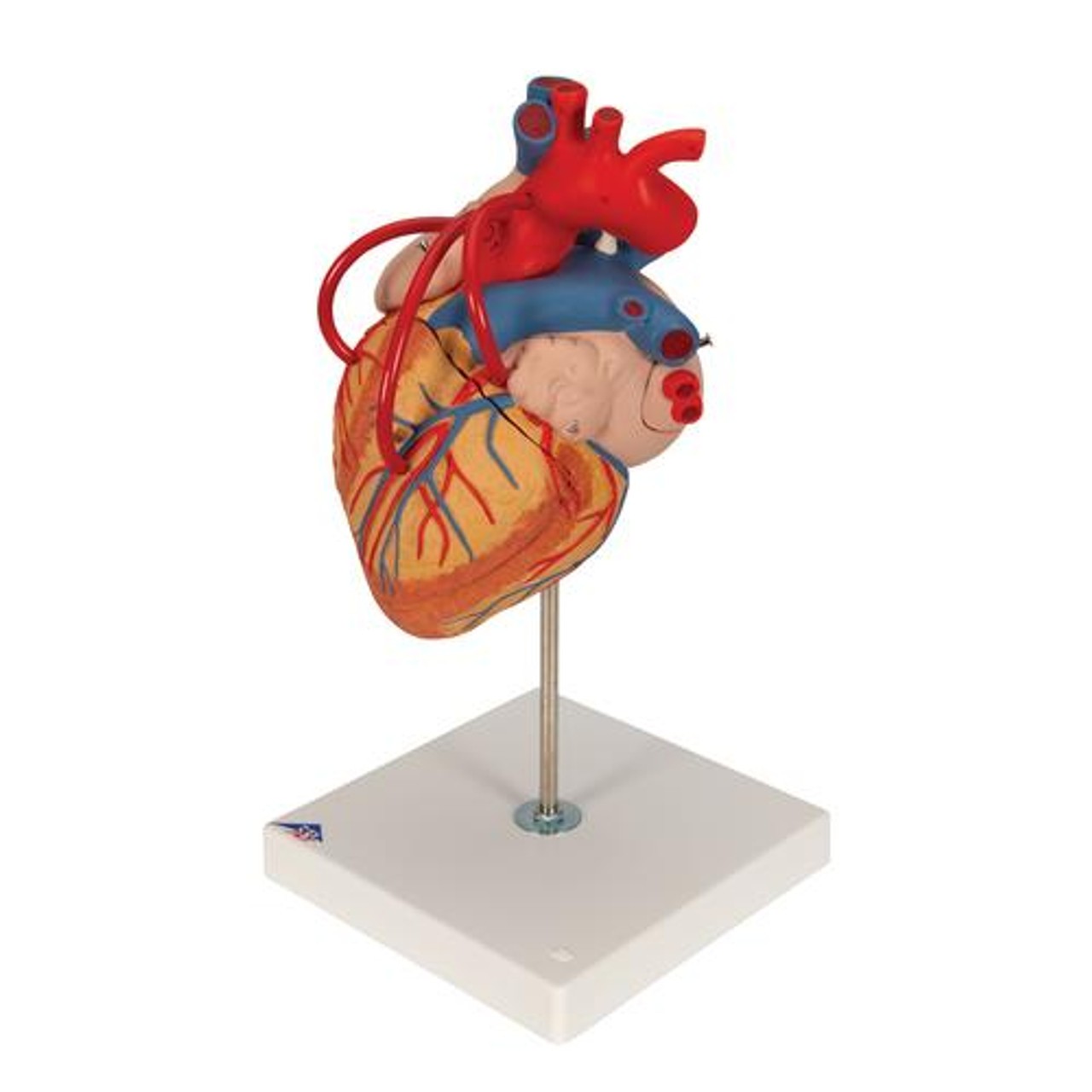 Human Heart Anatomy Model With Bypass - Left Side View
