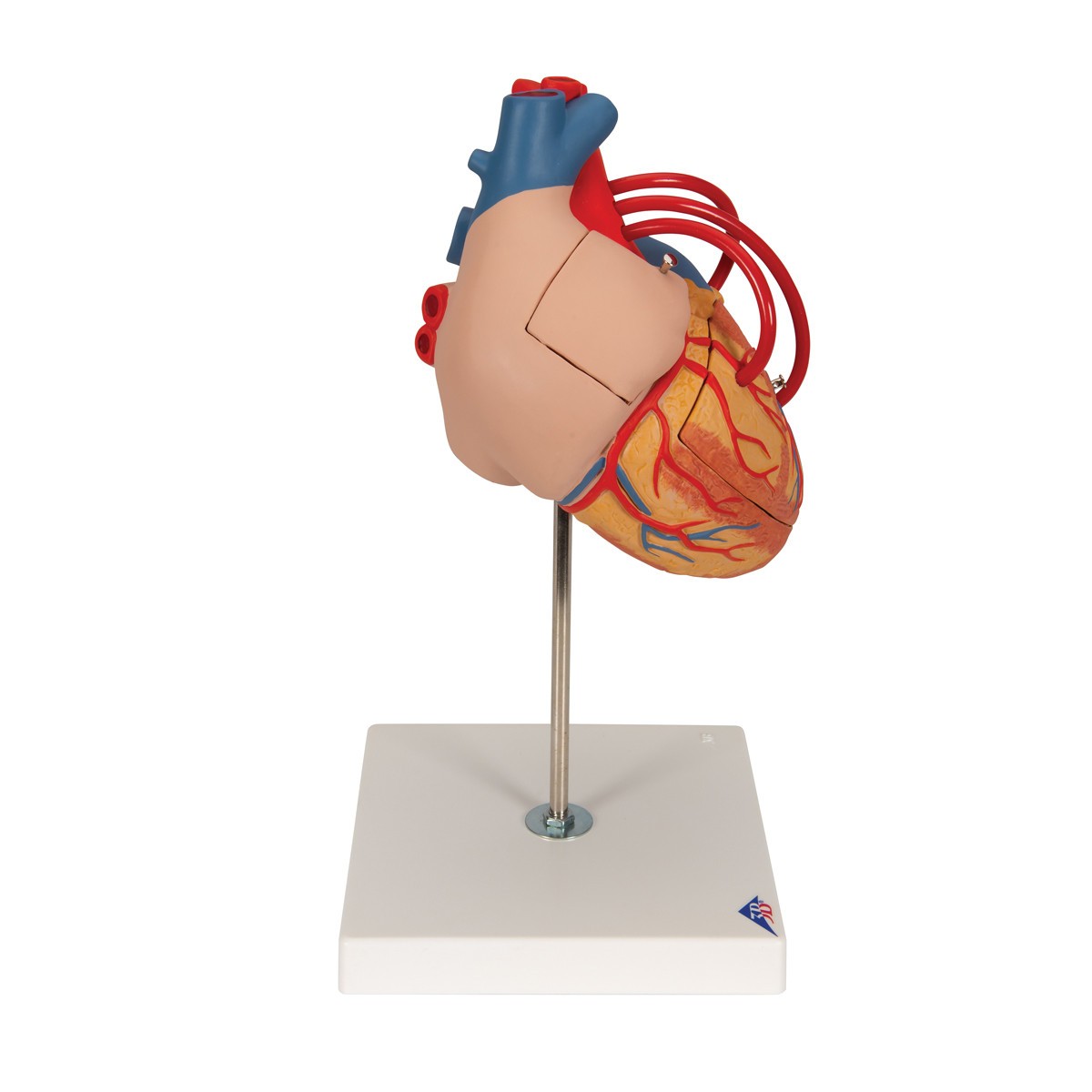 Human Heart Anatomy Model With Bypass