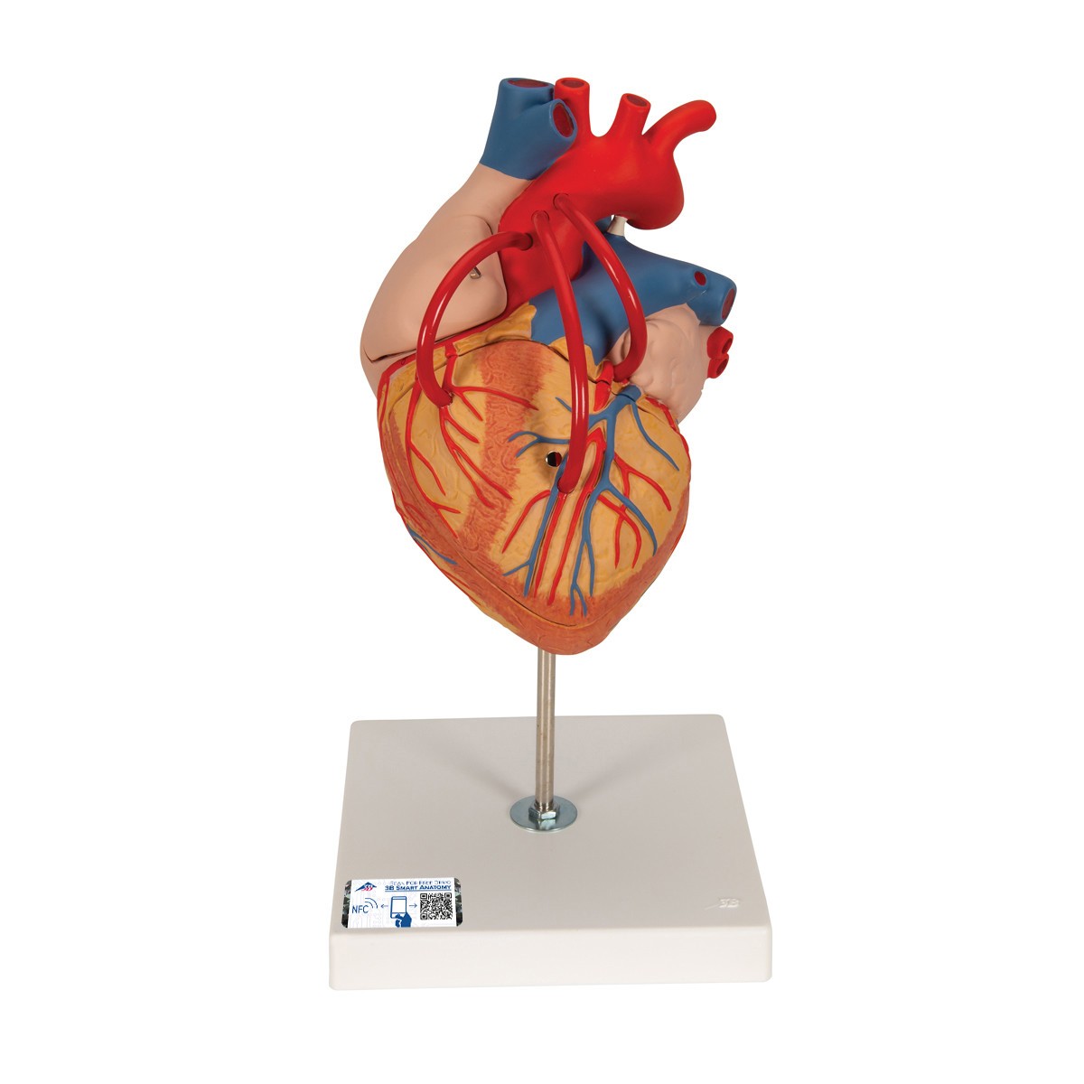 Human Heart Anatomy Model With Bypass