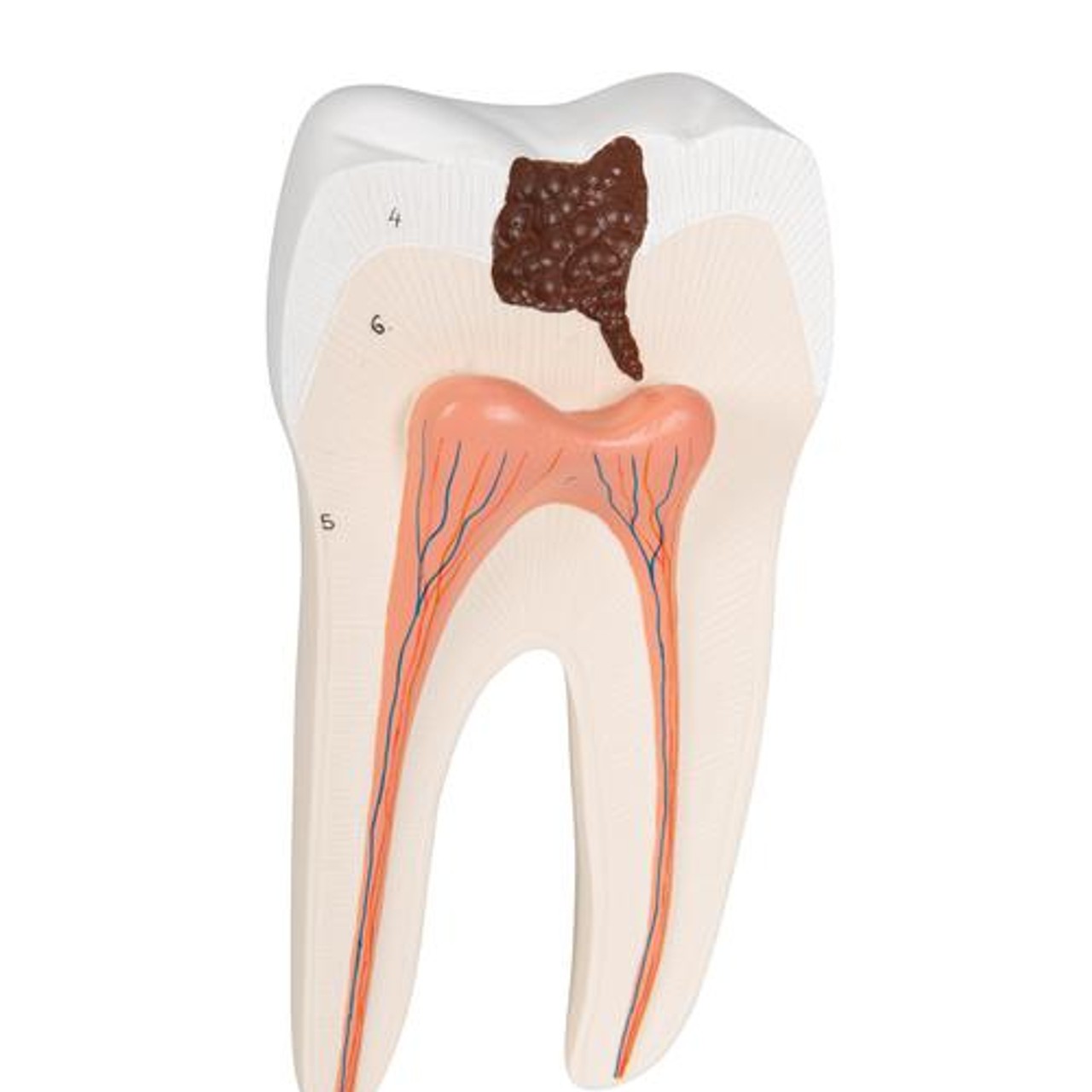 Lower Twin-Root Molar Anatomy Model 2 Parts