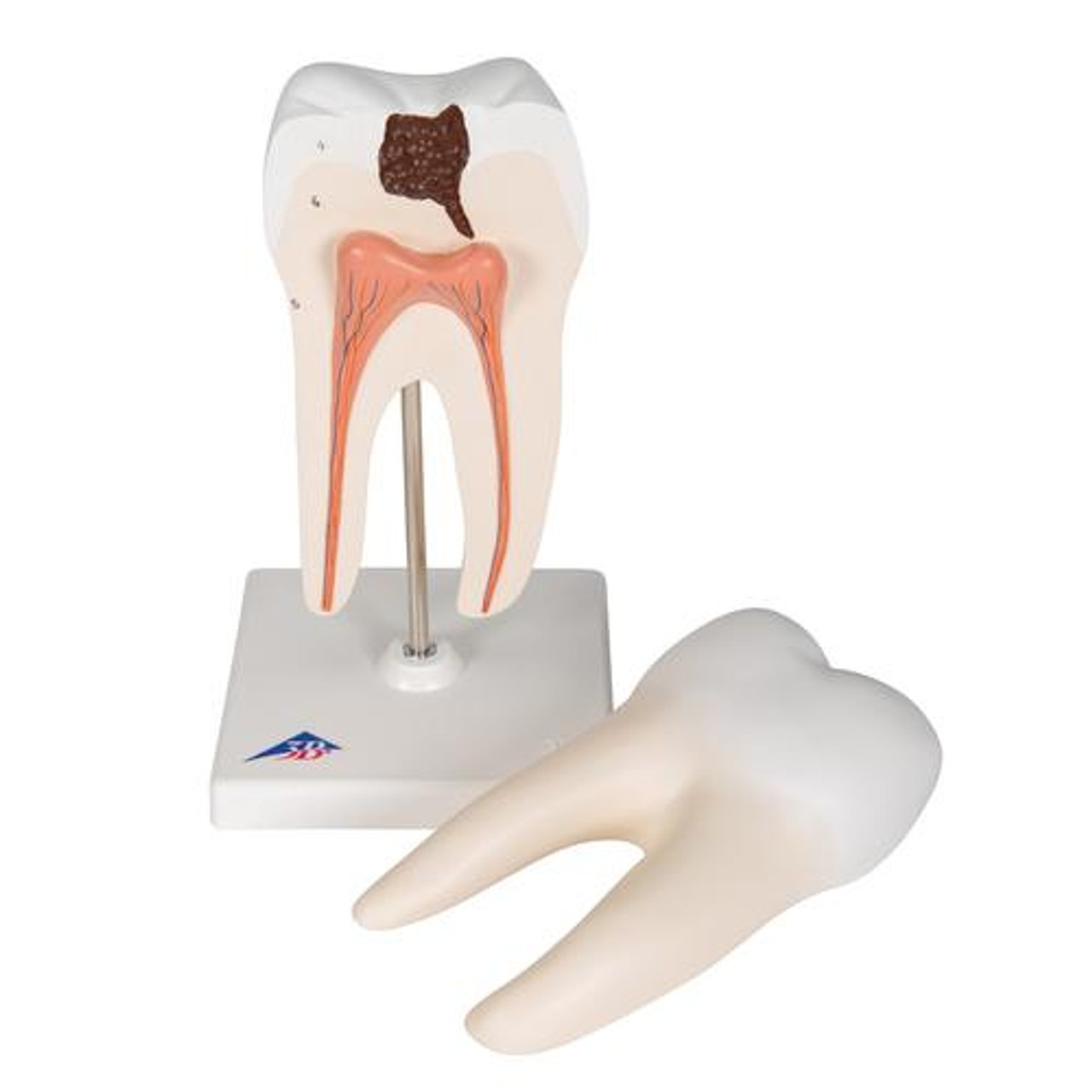 Lower Twin-Root Molar Anatomy Model 2 Parts