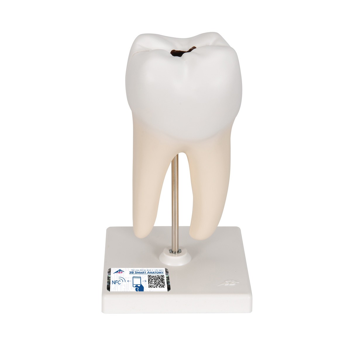 アナトミー 2 3B Scientific Lower Twin-Root Molar Anatomy Model 2 Parts
