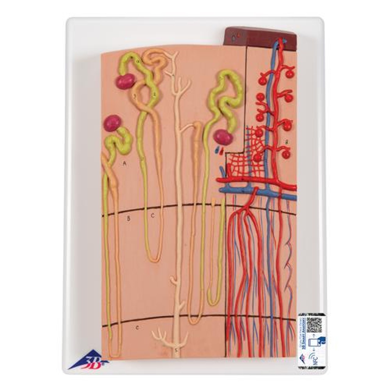 Kidney, Nephrons And Blood Vessels, XRenal Corpuscl Anatomische