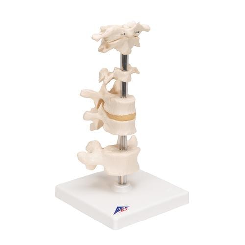3B Scientific 6 Mounted Vertebrae Anatomy Model | Anatomy Warehouse