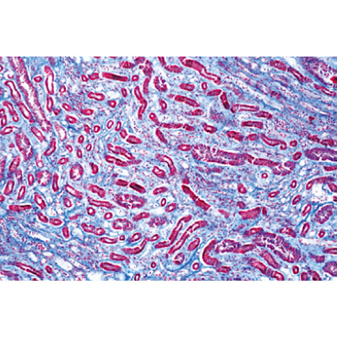 Human Pathology - English Microscope Slides Basic Set