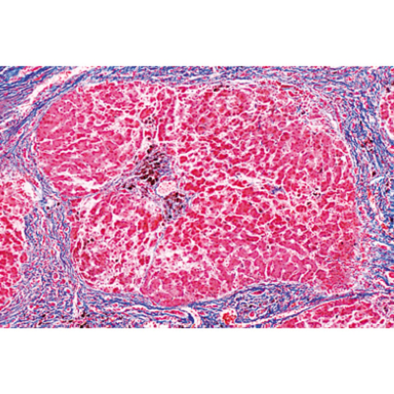 Human Pathology - English Microscope Slides Basic Set