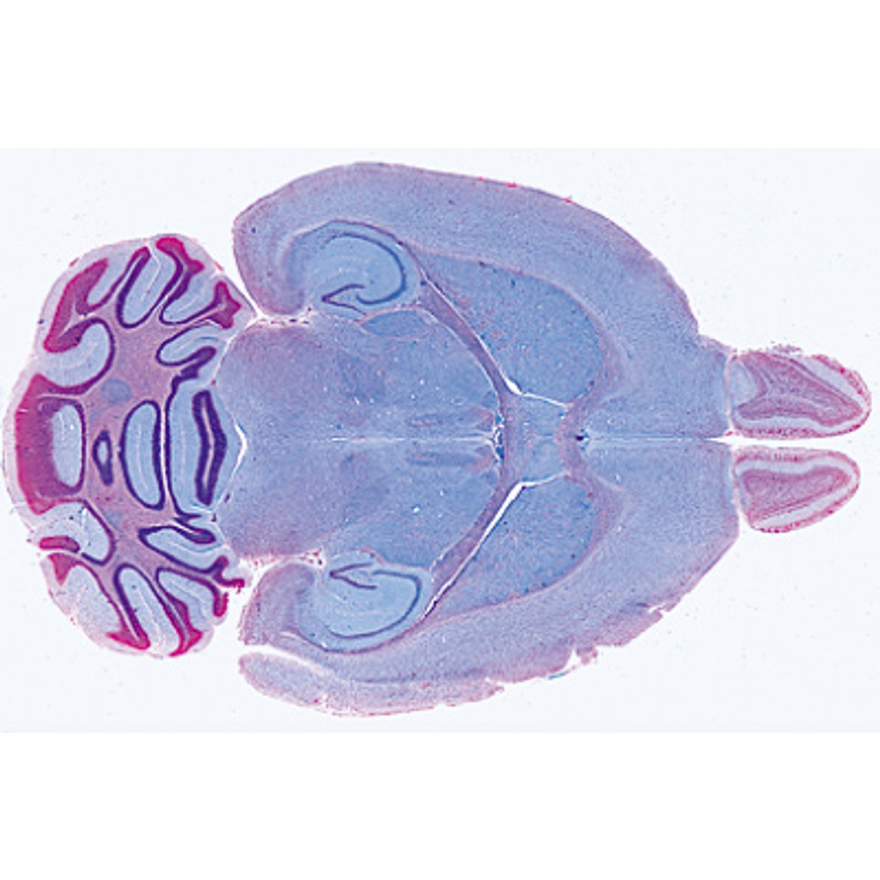 Human Nervous System - English Microscope Slides