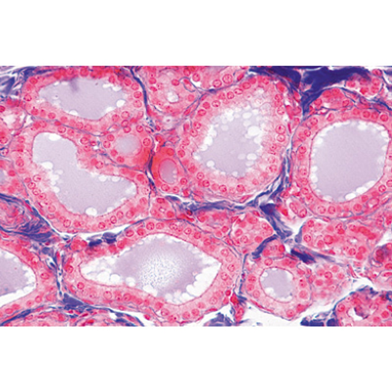 Endocrine System - English Microscope Slides