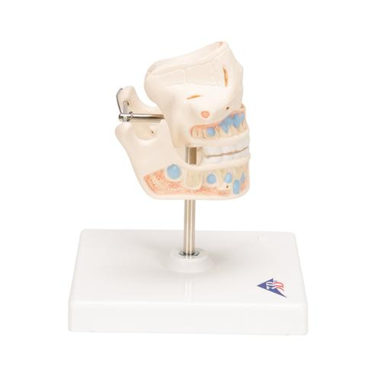 Milk Dentures Model - Right Side View