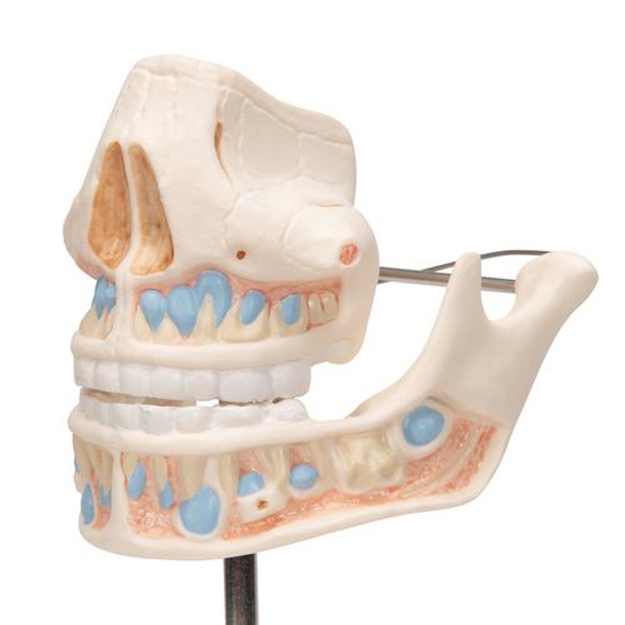 Milk Dentures Model - Zoom View