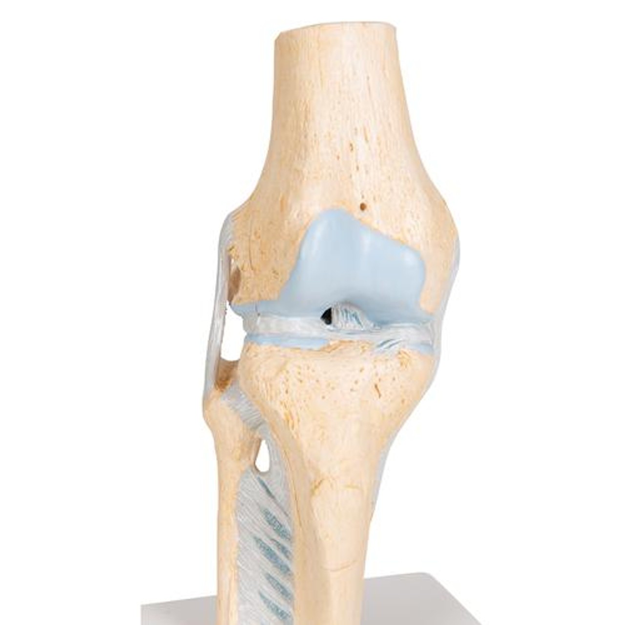 Sectional Knee Joint Anatomy Model - Detailed View