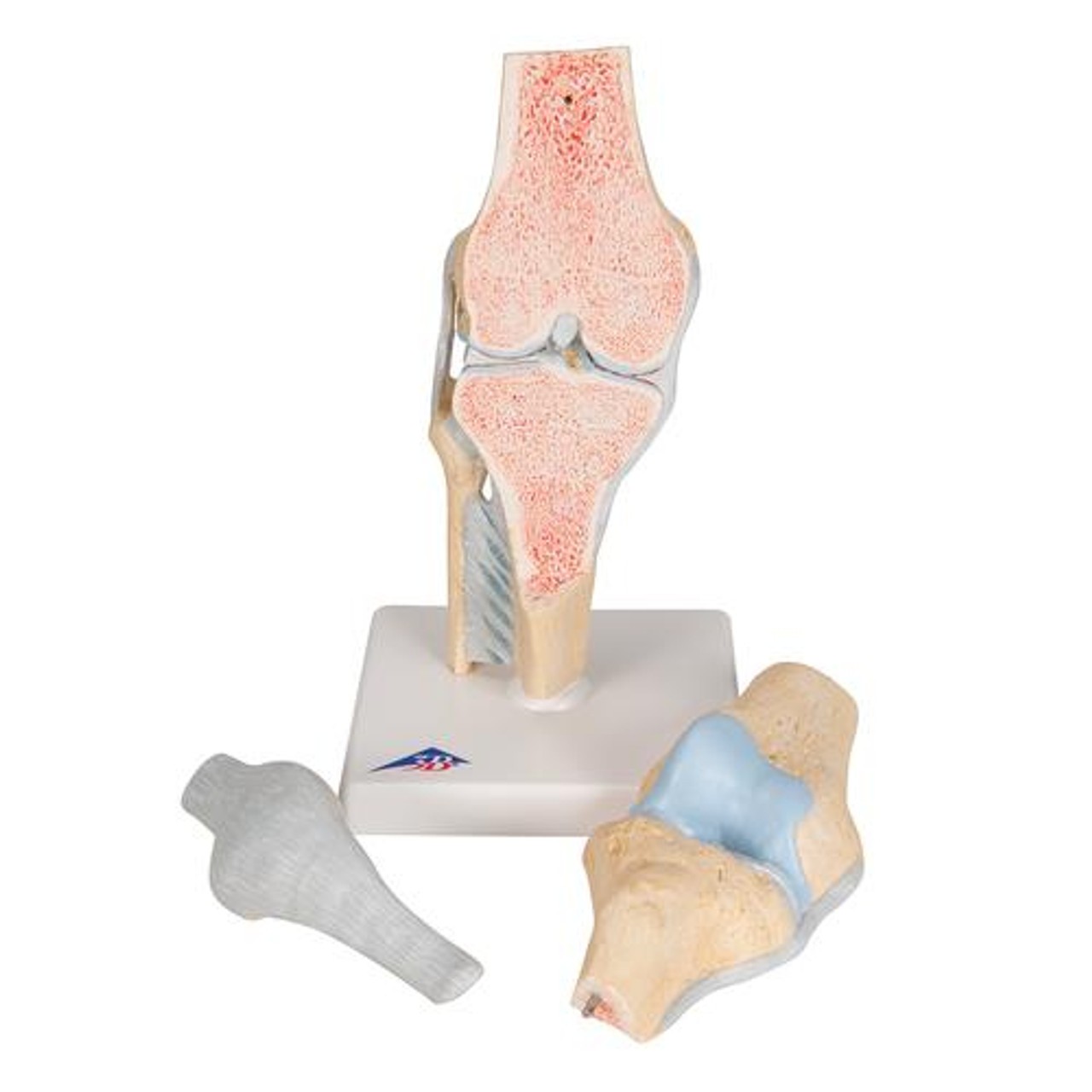 Sectional Knee Joint Anatomy Model - Removable Parts  View