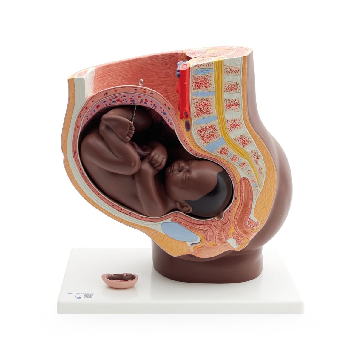 Pregnancy Pelvis Model with 40-Week Fetus, 3-Parts, Dark Skin
