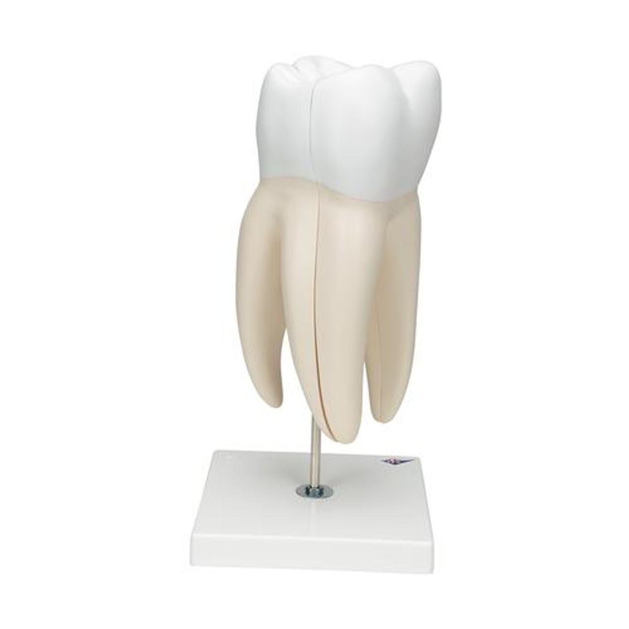 Giant Molar Anatomy Model With Dental Caries