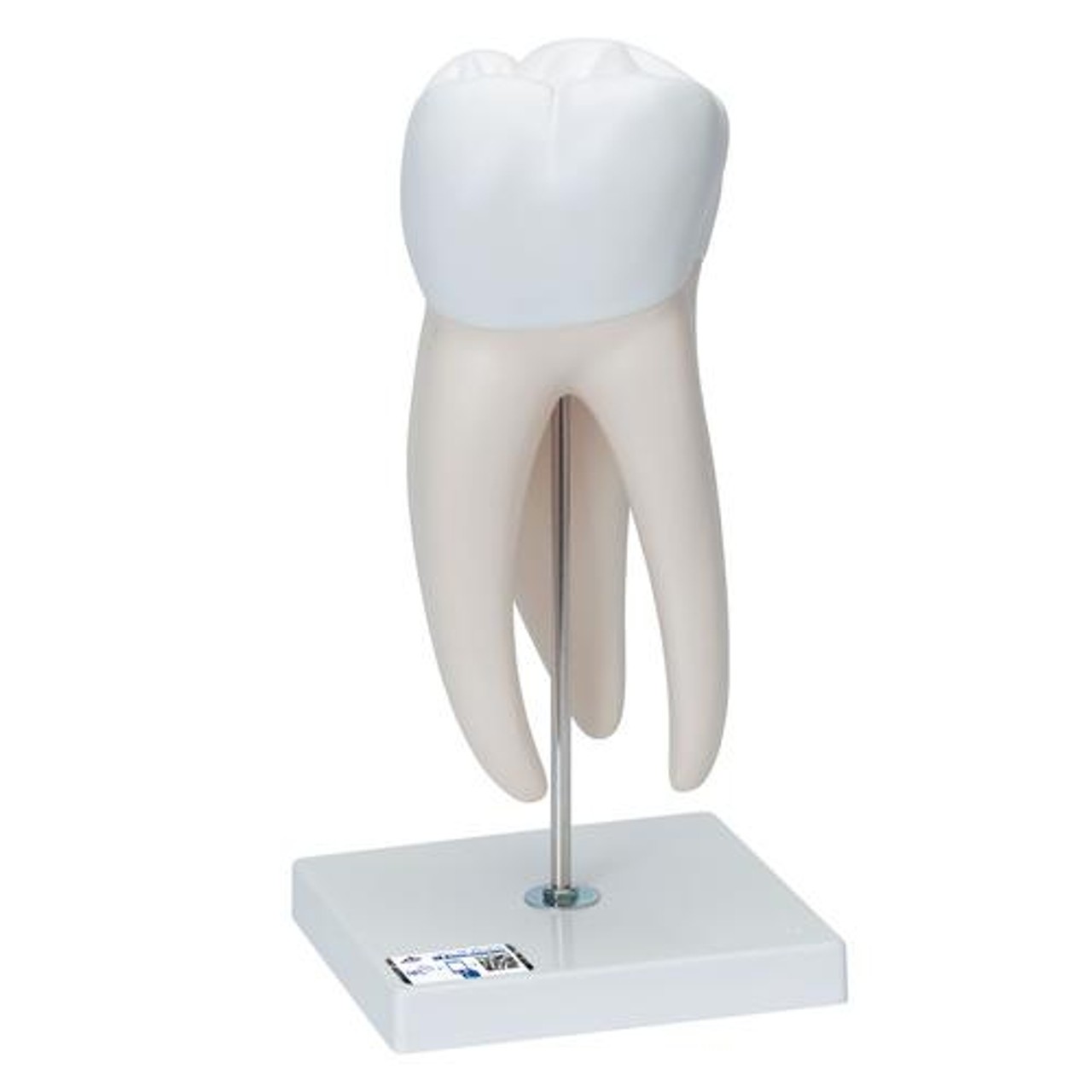 Giant Molar Anatomy Model With Dental Caries