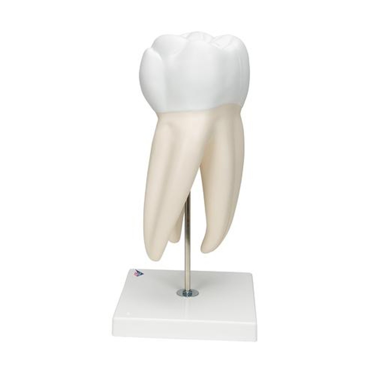 Giant Molar Anatomy Model With Dental Caries