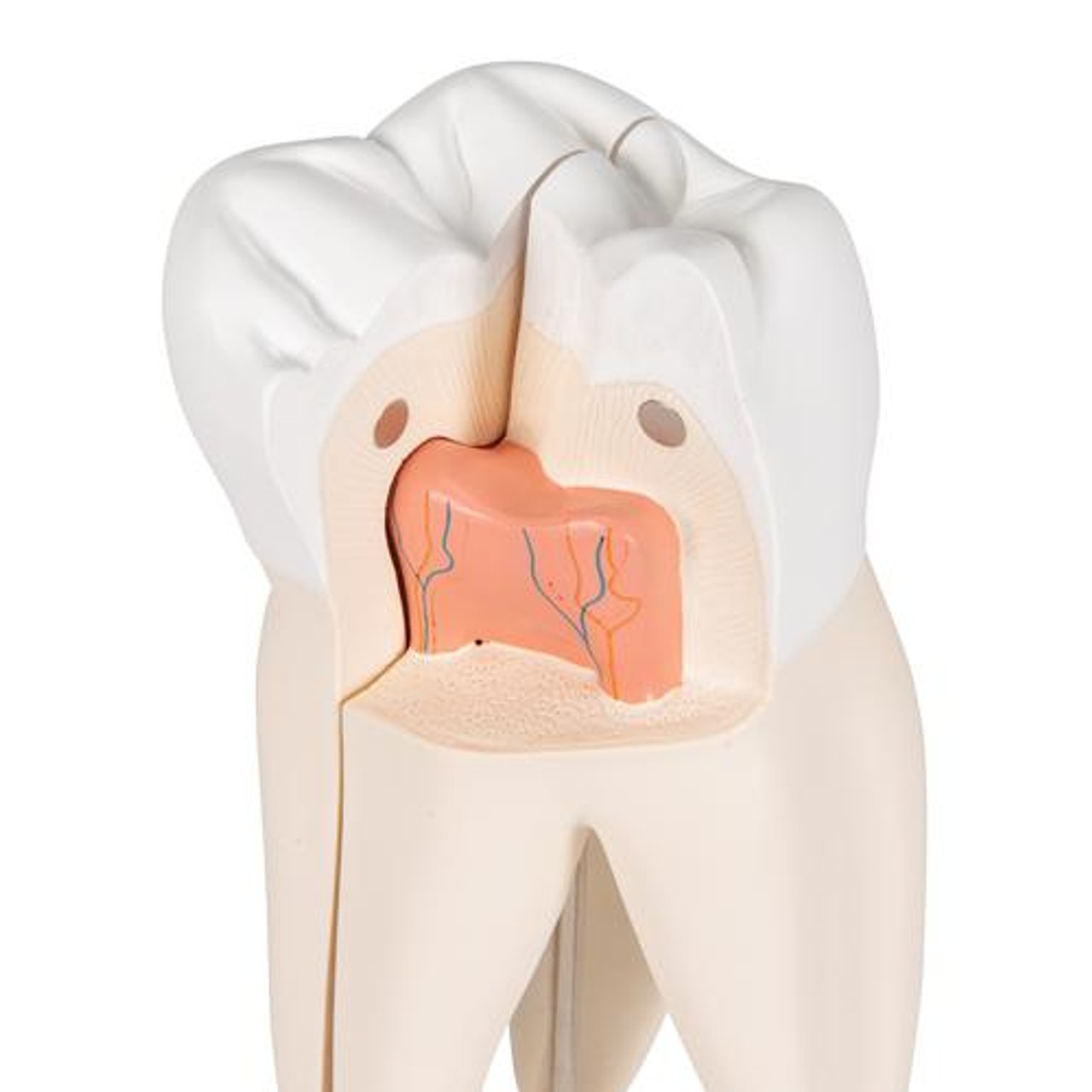 Upper Triple-Root Molar Tooth Anatomy Model