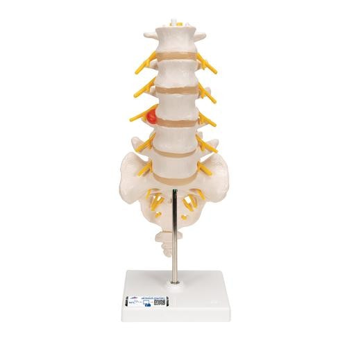 3B Scientific Lumbar Spinal Column Anatomy Model With Dorso
