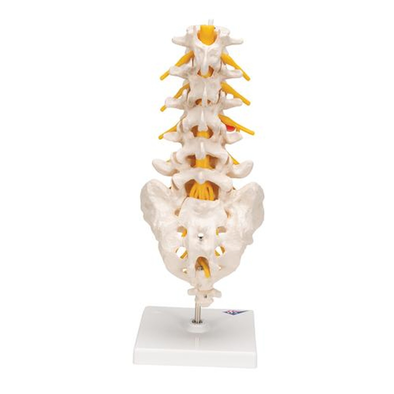 Lumbar Spinal Column Anatomy Model With Dorso-Lateral Prolapsed Intervertebral Disc