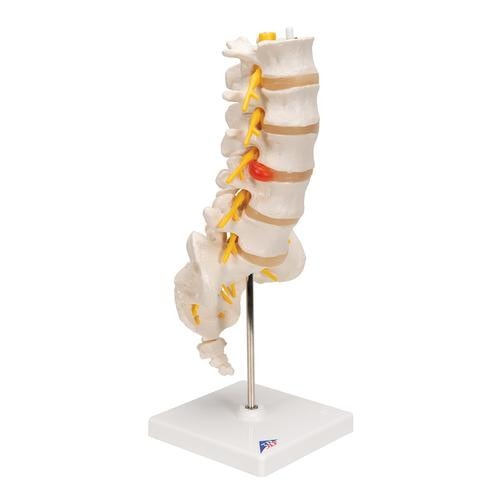 3B Scientific Lumbar Spinal Column Anatomy Model With Dorso
